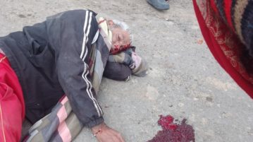 शराब के नशे में चूर दो व्यक्तियों ने आपस में ईट पत्थर से वार कर एक दूसरे को किया घायल
